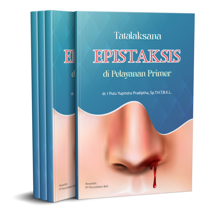 Tatalaksana Epistaksis di Pelayanan Primer